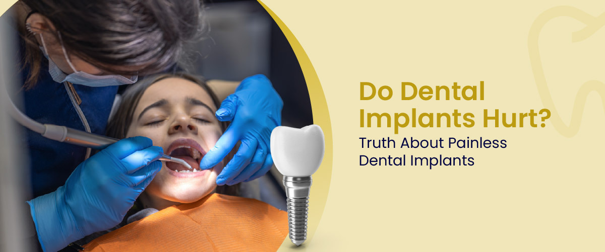 Do Dental Implants Hurt