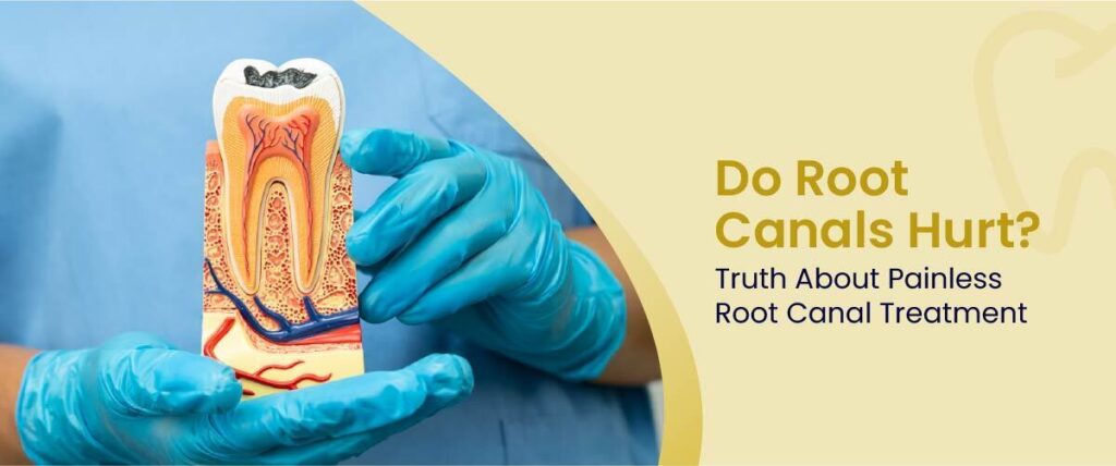 Do Root Canals Hurt