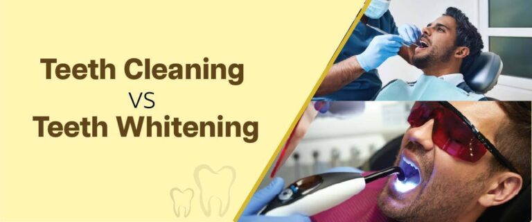 Is Teeth Whitening Safe? Myths vs. Facts You Should Know