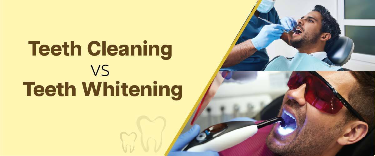 Teeth Cleaning vs. Teeth Whitening