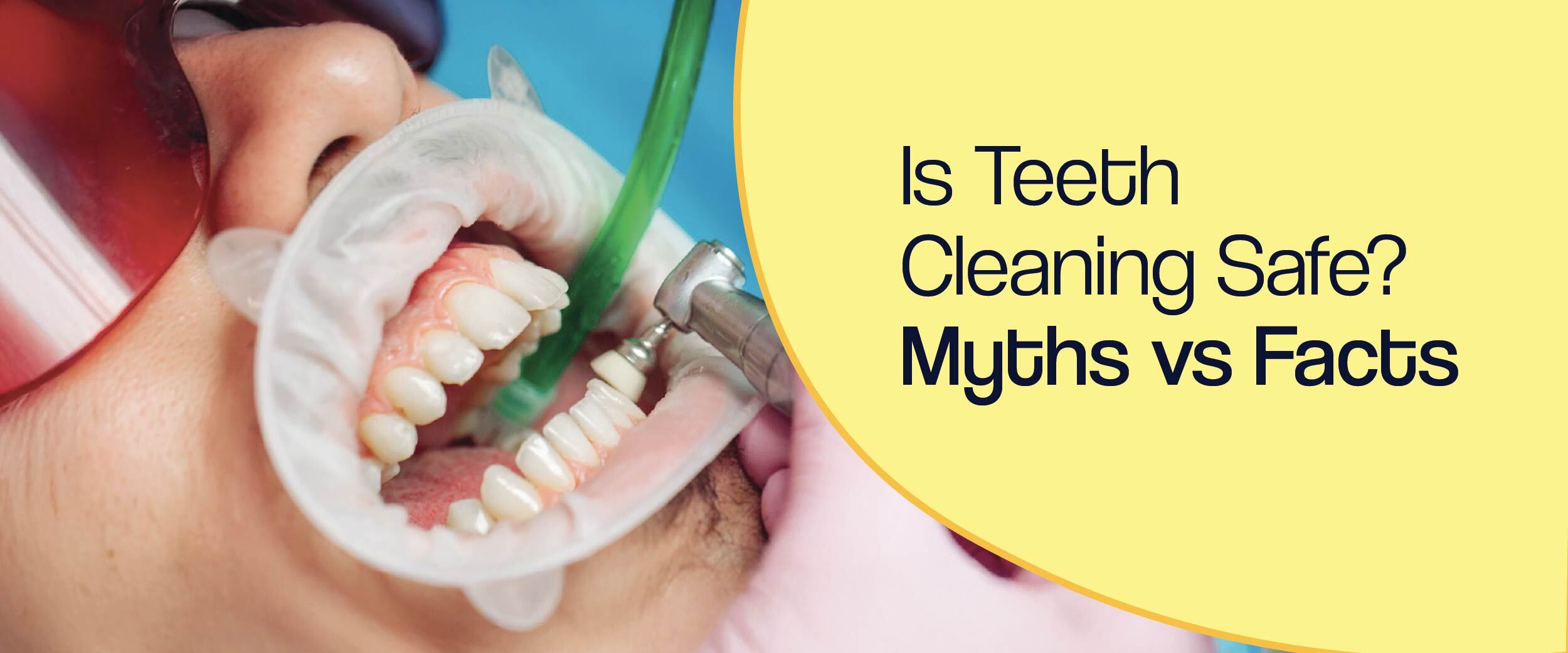 Is Teeth Cleaning Safe