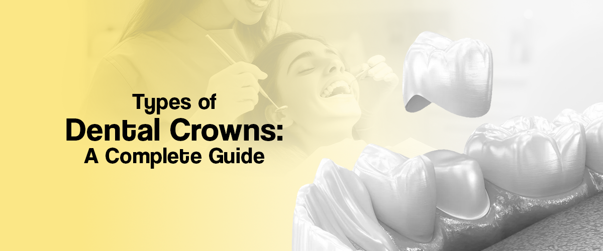 Types of Dental Crowns: A Complete Guide